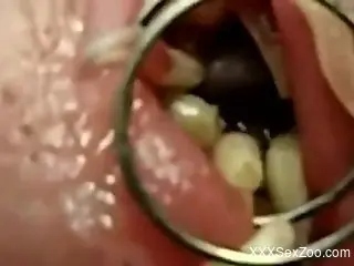 Dude's urethra is now filled with lots of maggots